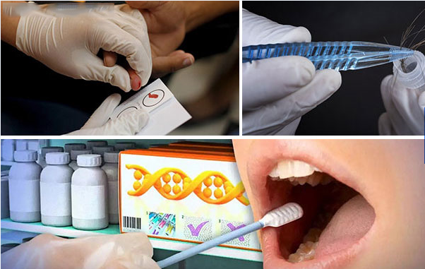 必须本人到场吗？南京亲子鉴定样本采集方式大全